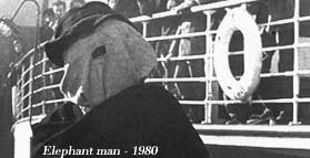 Elephant man